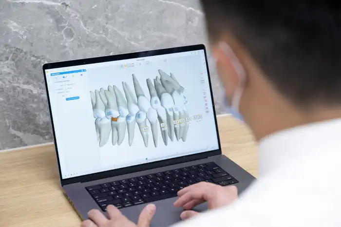 Digital orthodontic treatment planning on a computer
