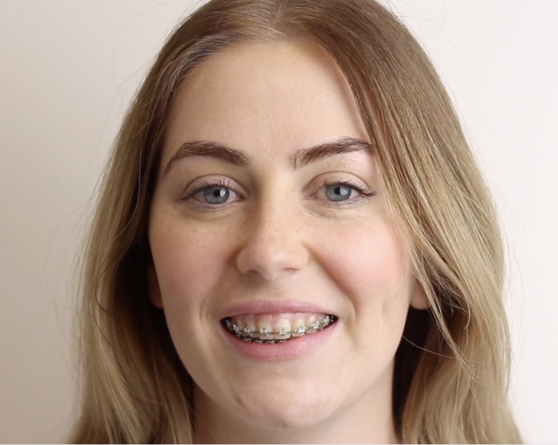 Go Orthodontics patient smiling with clear ceramic braces